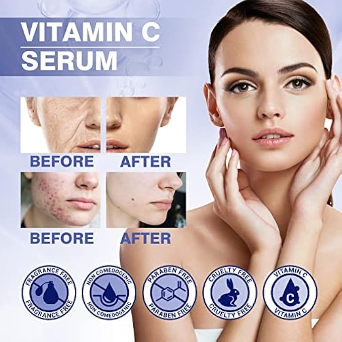STRBOXONG VITAMIN C FACIAL FINE LINES AROUND THE EYES MOISTURIZING MOISTURIZING SKIN DEEP CLEANSING MOISTURIZING FIRMING SKIN CARE MOISTURIZING FACIAL 30ML JAPANESE SKIN CARE PRODUCTS (PINK, ONE SIZE) - Image 2